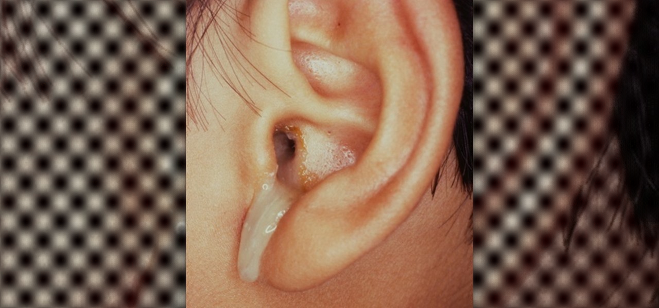 Deal with Ear Discharge