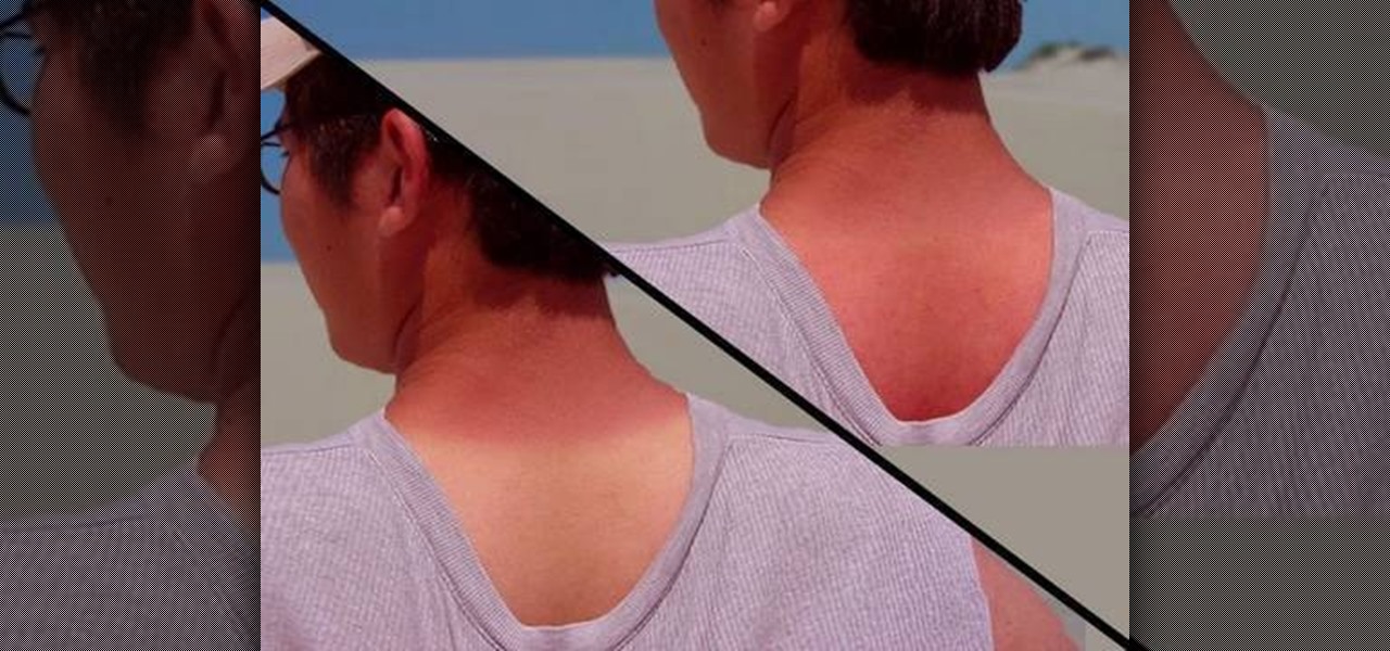 How to Get Rid Of Those Accidental Tan Lines