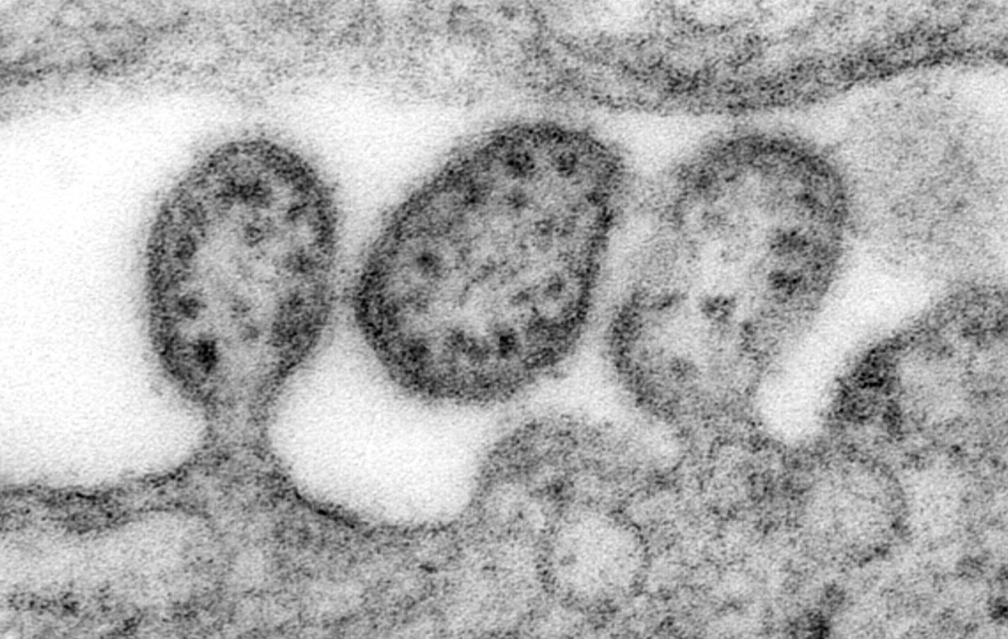 New Research May Help Stop Deadly Lassa Virus