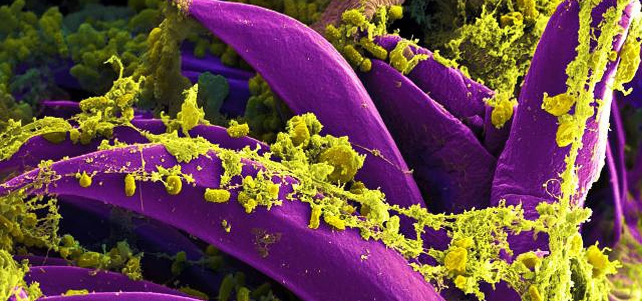 New Class of Antibiotics Could Treat Plague & Multi-Drug Resistant Superinfections