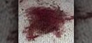 Remove blood stains on carpet