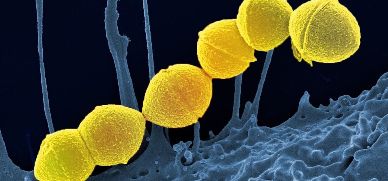 Teeny Sponges Being Created to Float in Your Blood, Sop Up Bacterial Toxin & Prevent Flesh-Eating Disease