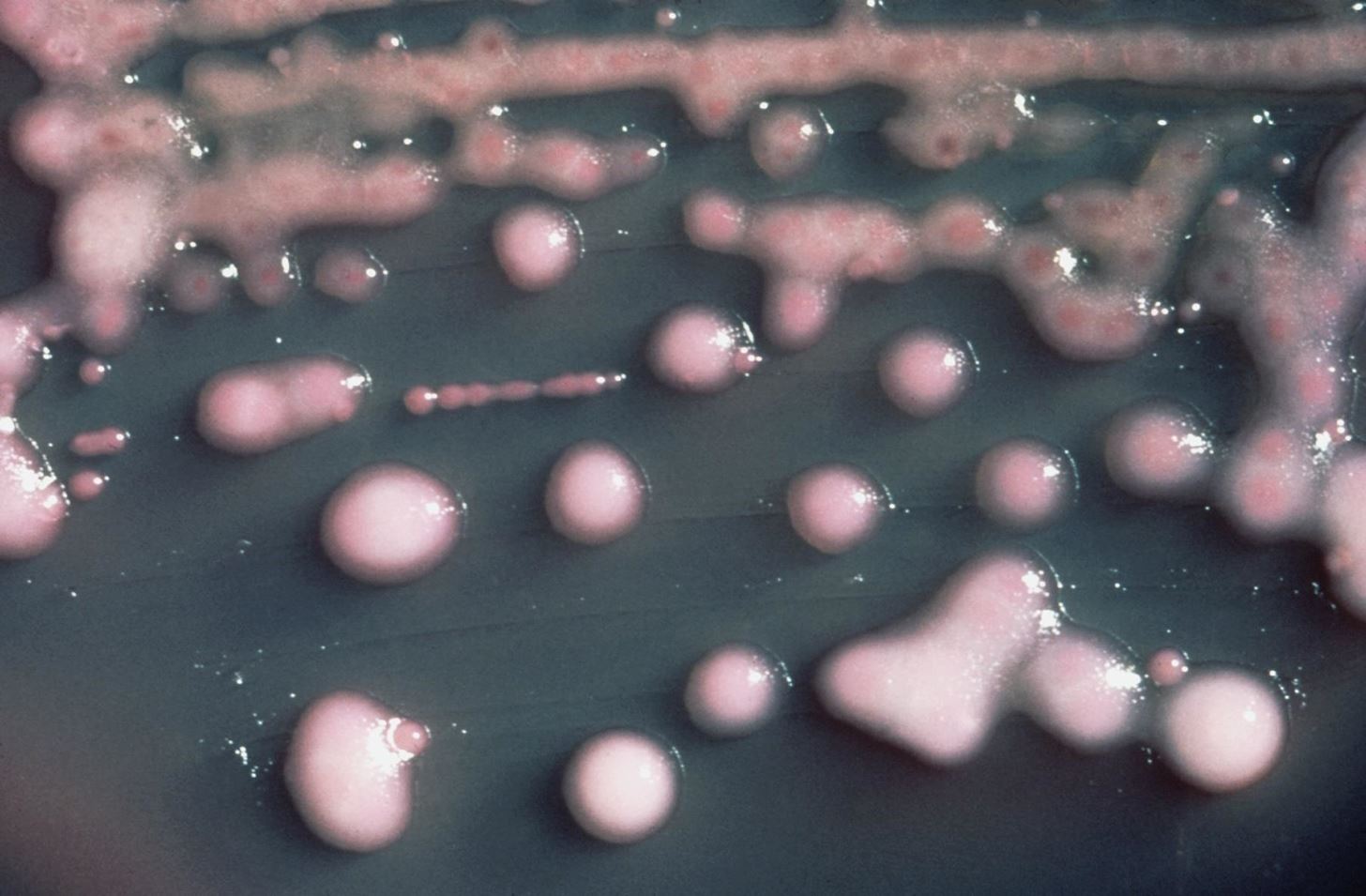 Why You Should Care About the Nevada Woman Killed by the Totally Resistant Nightmare Superbug