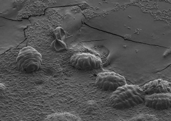 Tardigrades Are the Earth's Toughest & Almost-Immortal Animals