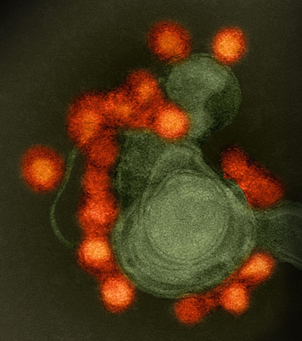 In the Ultimate Irony, Zika Virus May Cure Brain Cancer