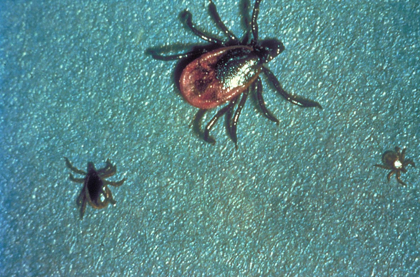 Some Treatments for 'Chronic Lyme' Are More Deadly Than the Disease Itself