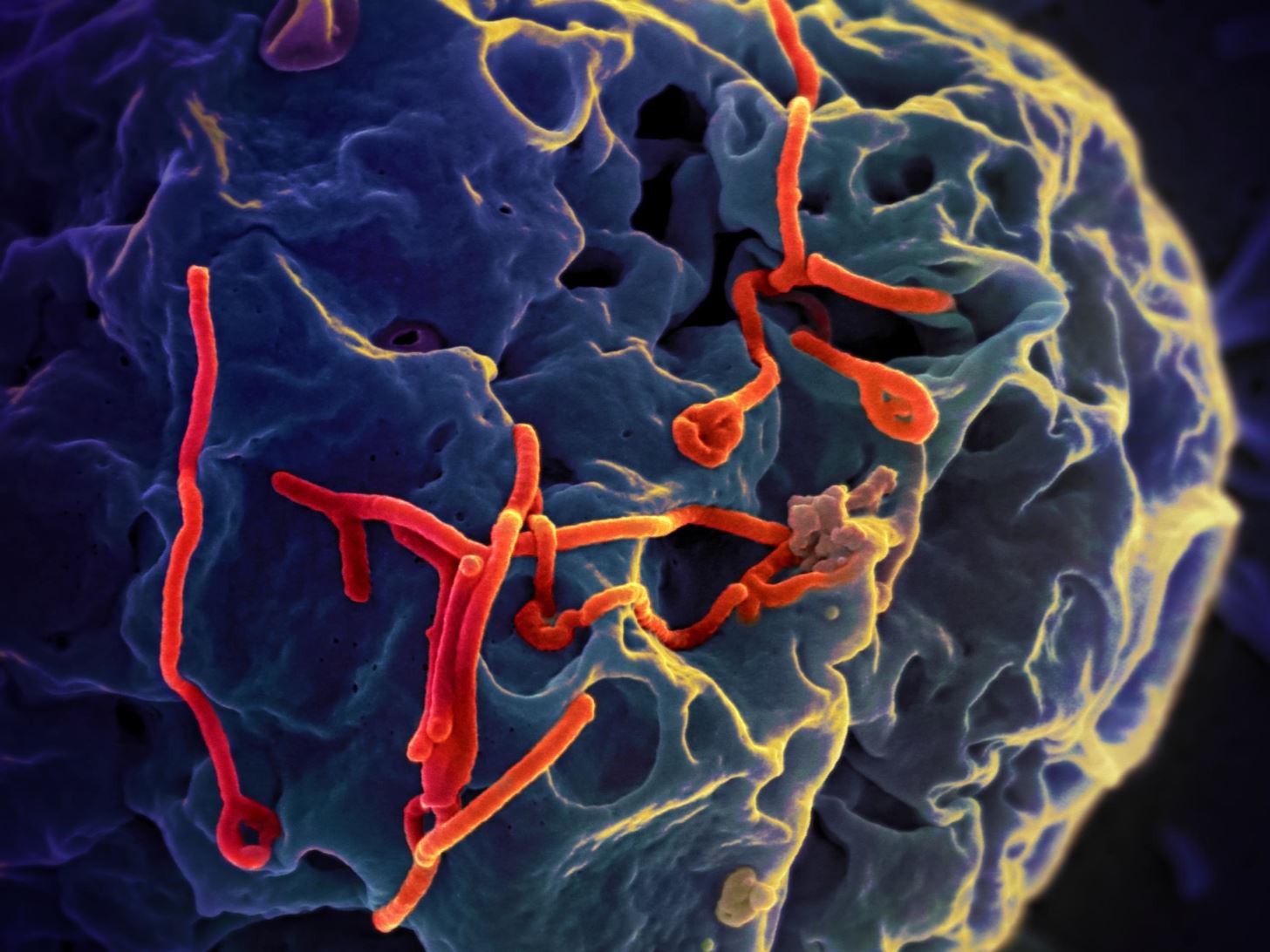 Ebola Survivor May Hold Key to Curing All Types of Ebola Infections