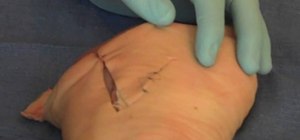 Suture the dog ear of a wound closed