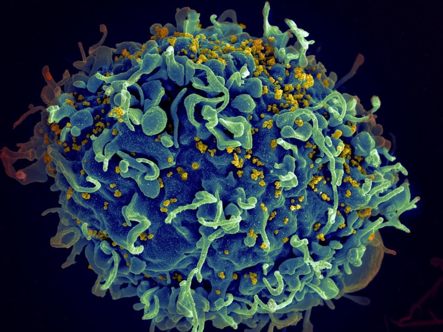 Scientists Discover How to Track Down HIV's Hiding Spots—A Potential Pathway to a Cure
