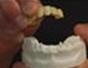 Learn about dentures and false teeth - Part 8 of 9