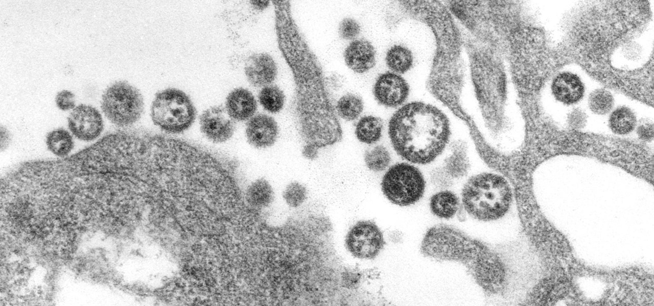 New Research May Help Stop Deadly Lassa Virus