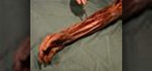 Dissect a human to see the forearm and hand muscles