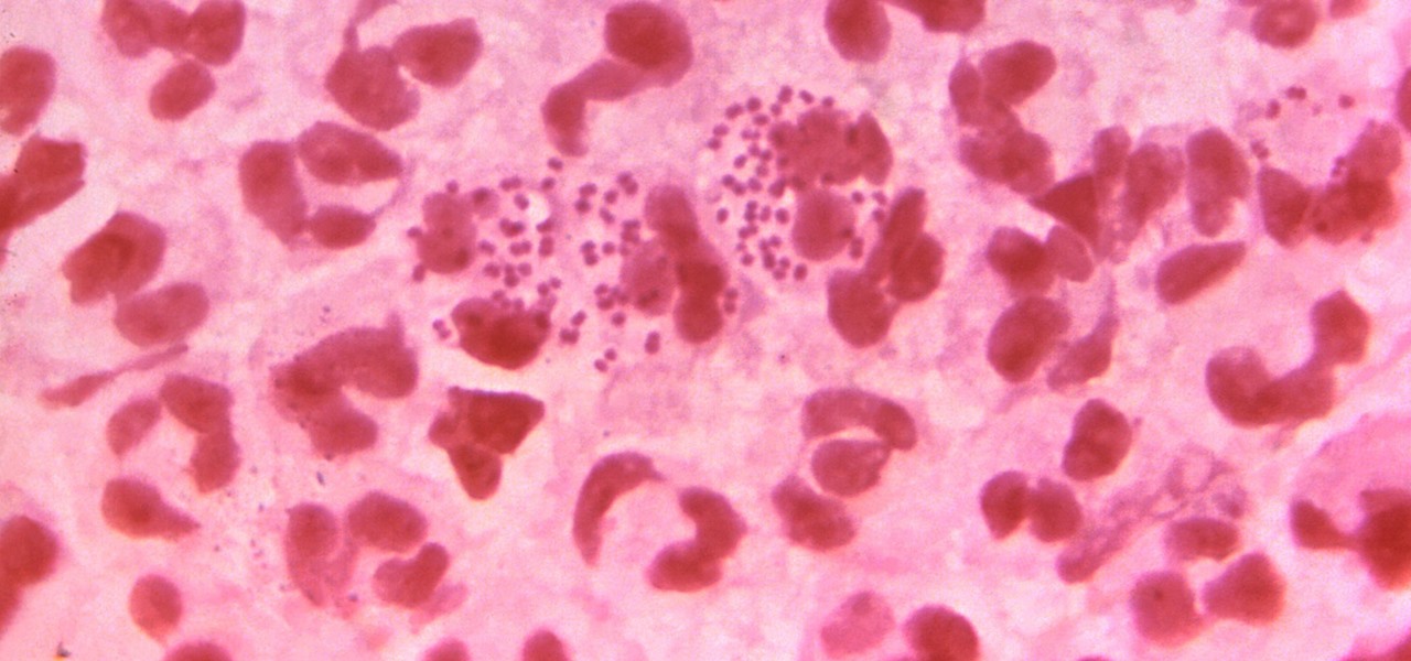 Untreatable 'Super Gonorrhea' Spreading Like Wildfire — Luckily, It May Have a New Opponent