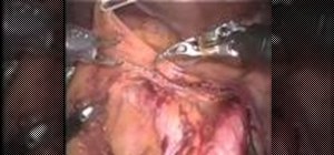 Dissect a left aortic lymph node with a robotic arm