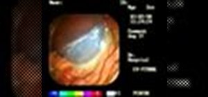 View a mare reproductive tract through laparoscopy