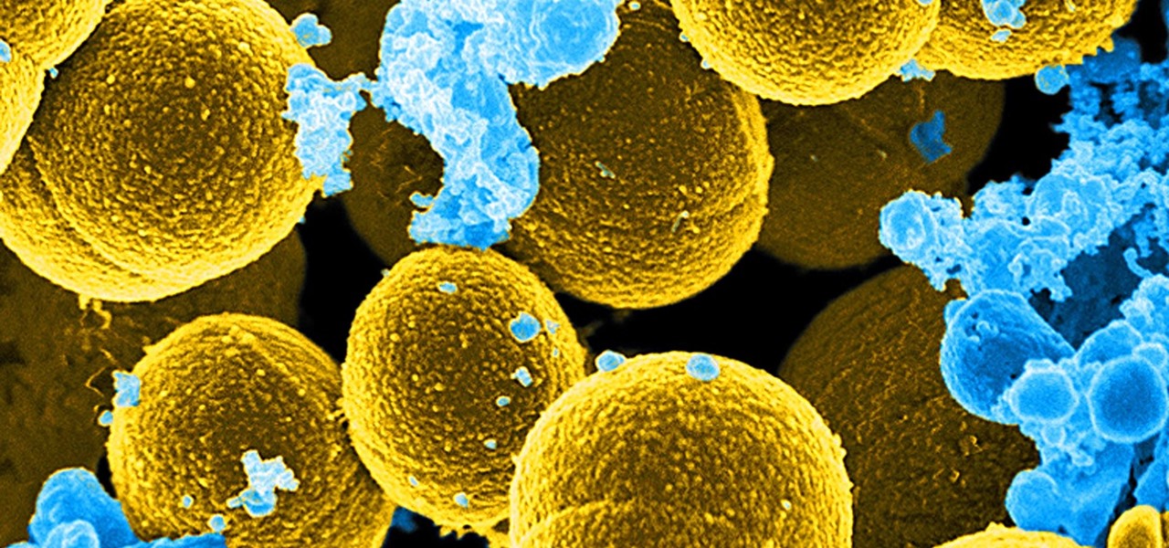 Mysteriously, a Huge Study Finds a Drop in Antibiotic Resistant (MRSA) Infections