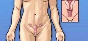 Treat vaginal fibroids