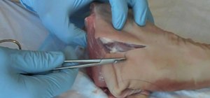 Use proper suture technique with your patient