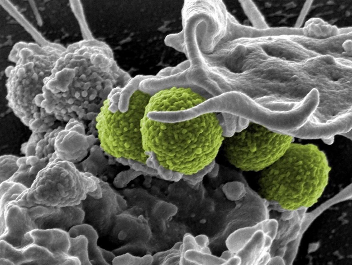 Toxic Shock Syndrome: How Bacterial Toxins Can Turn Our Immune System Against Us
