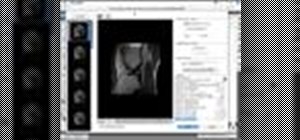 Open and edit DICOM files in Photoshop CS3 Extended