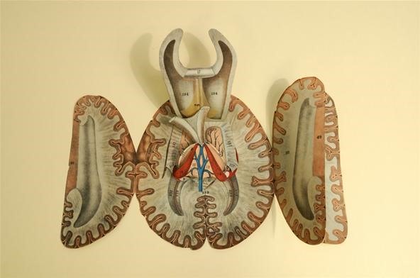 Human Dissection Illustrated in Anatomical Pop-Up Books