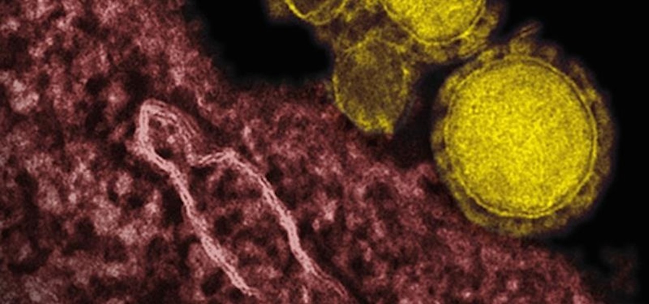 Ebola Drug May Offer Safe and Effective Treatment for SARS & MERS