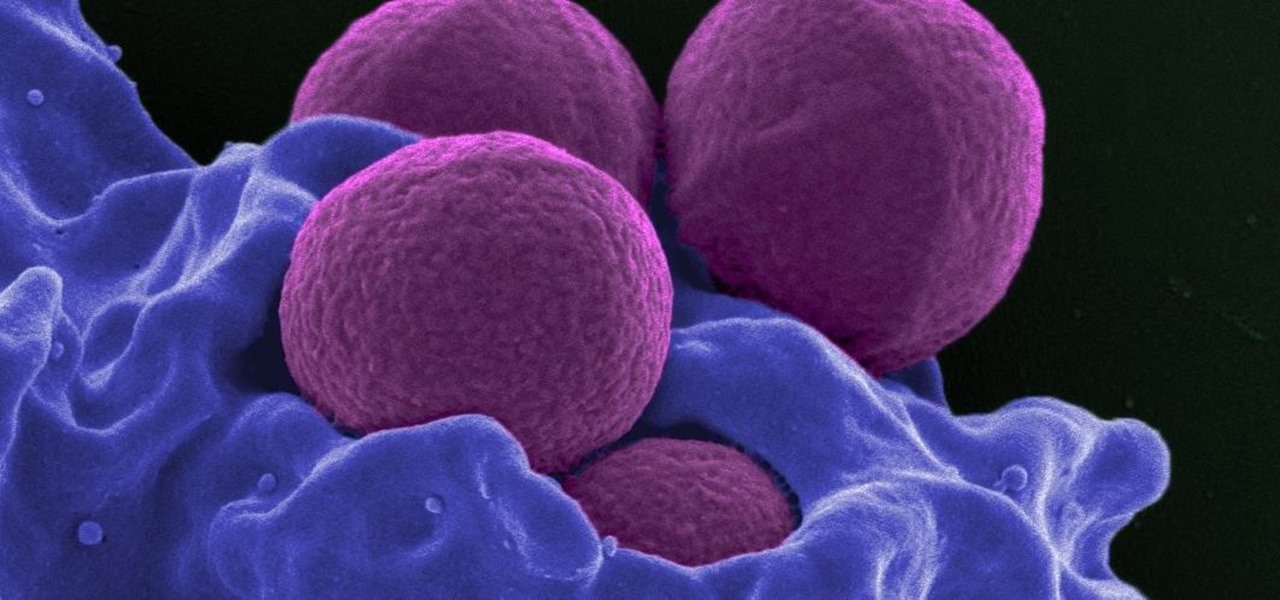 Happy News: Common Drugs May Save You from MRSA