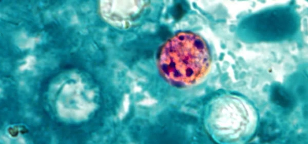 CDC Warns About a Big Spike in Cyclospora Infections — Here's What That Is & How to Avoid It