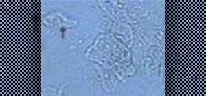 Identify bacterial vaginosis clue cells