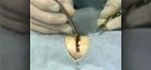 Do basic suturing in the emergency room