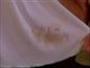 Remove rust stains from clothes