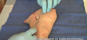 Suture a wound with a skin flap closed