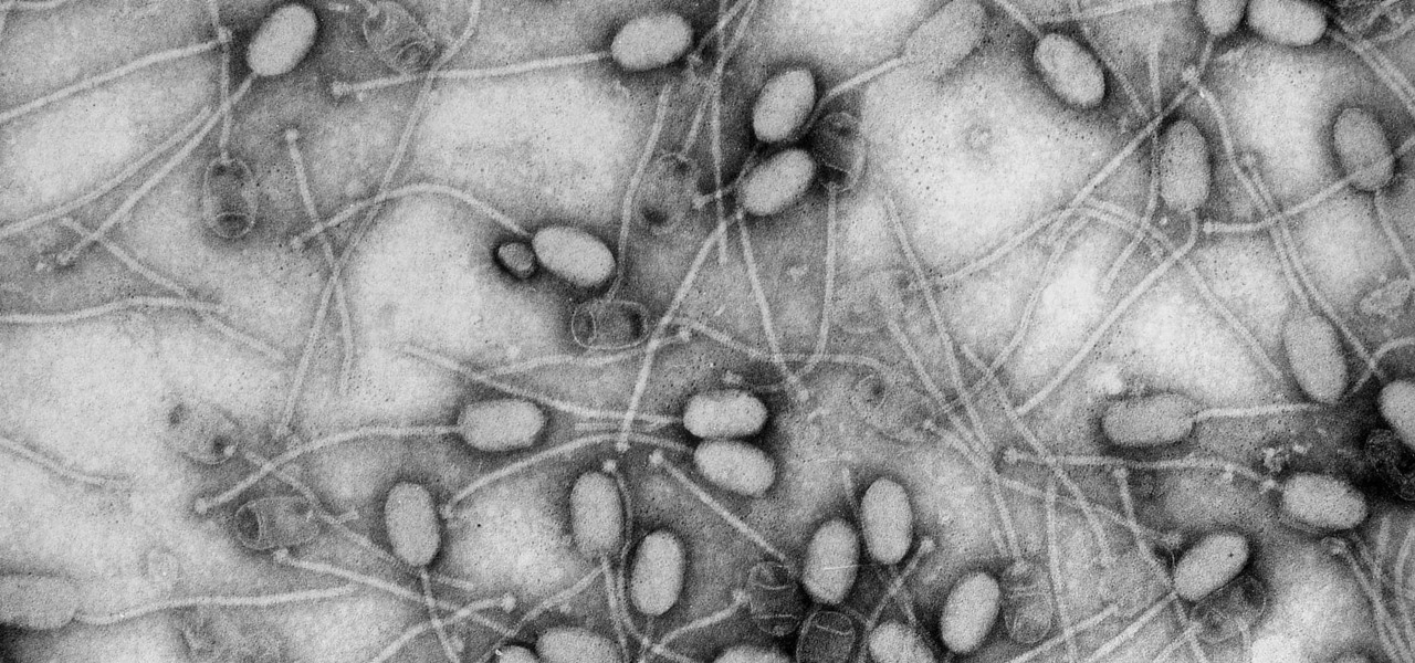 Bacteria-Killing Viruses Can Help Us Take Down Superbugs