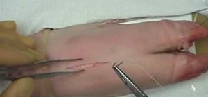 Perform an interrupted and a subcuticular suture