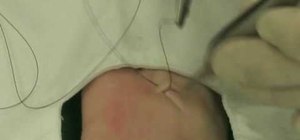 Suture a wound and understand suturing techniques