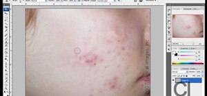 Remove acne spots with Photoshop