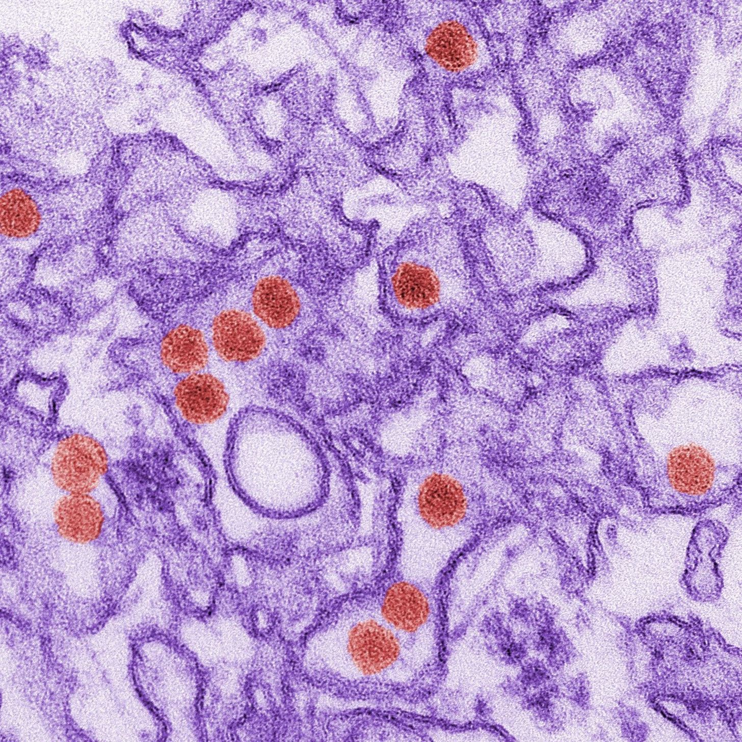Researchers Have Found Zika's Sweet Spot & Potential Key to Fetal Infections