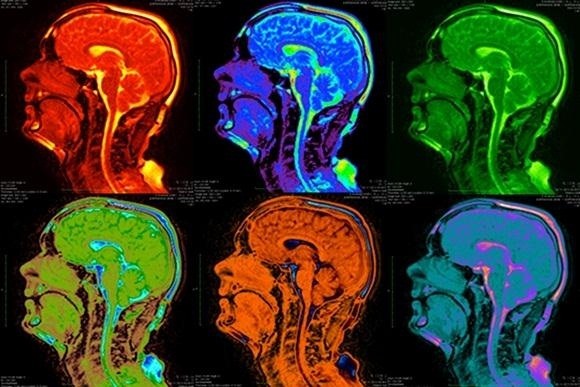 Your Brain on Music: How to Turn an MRI Scan into a Music Video