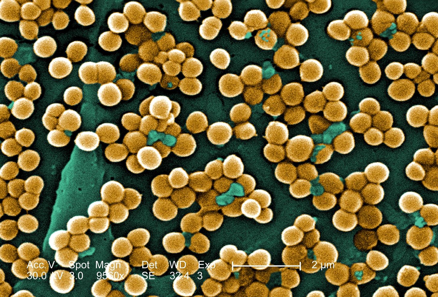 Microbes Are Everywhere—But Those on Your Cell Phone Can Be Dangerous, Especially During Cold & Flu Season